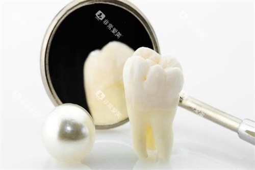 假牙模型细节图