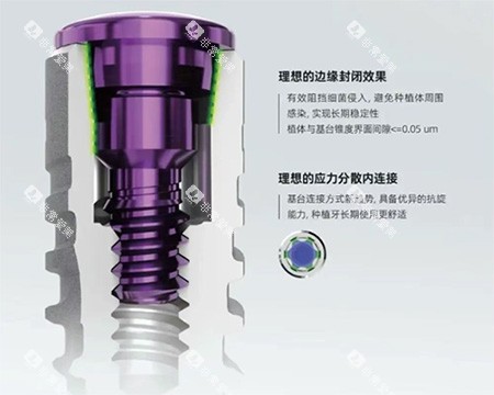 卡尔斯种植牙特色照片