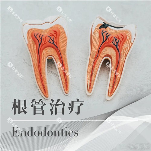 根管治疗图示 根管治疗图示