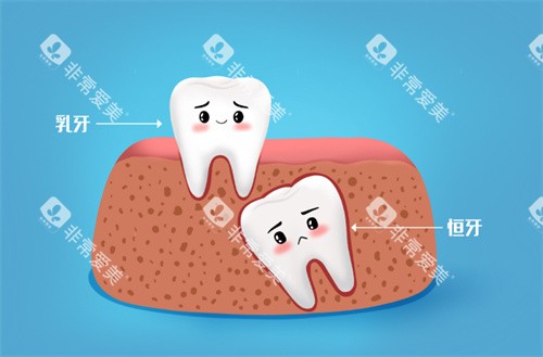 乳牙滞留 乳牙滞留