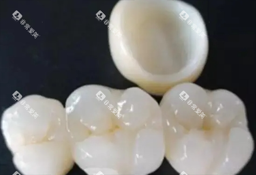 全瓷牙展示