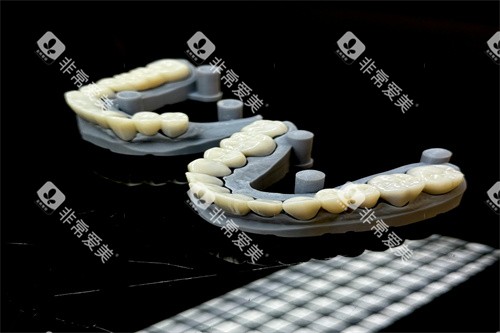 假牙的模型样子