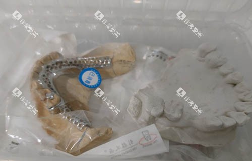 假牙托板照片