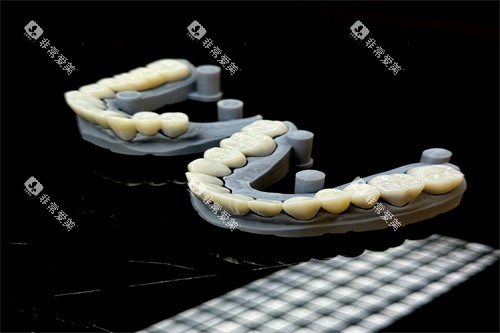 假牙的模型样子
