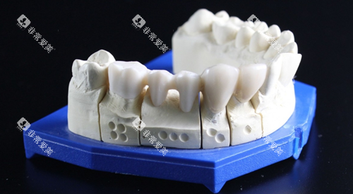 牙齿模型图