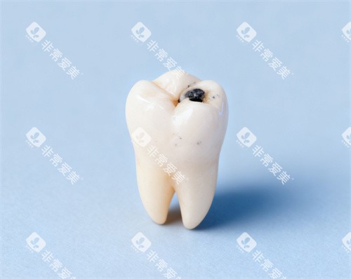 牙齿图片 牙齿图片