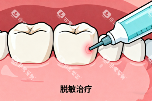 牙齿敏感治疗卡通图