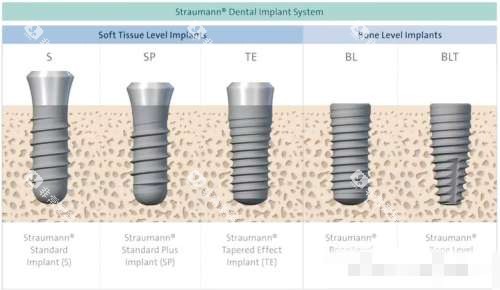士卓曼软组织水平种植体图片 士卓曼软组织水平种植体图片