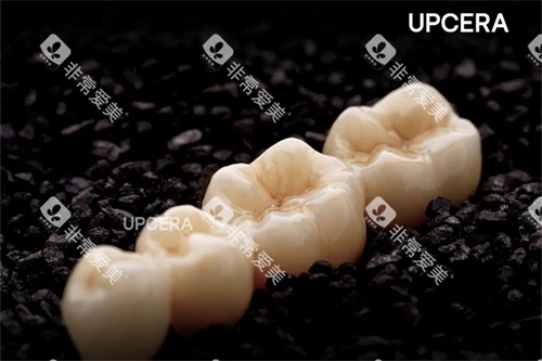 爱尔创-瓷倍健全瓷牙 爱尔创-瓷倍健全瓷牙