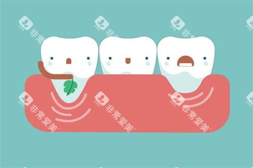 牙齿治疗过程卡通图
