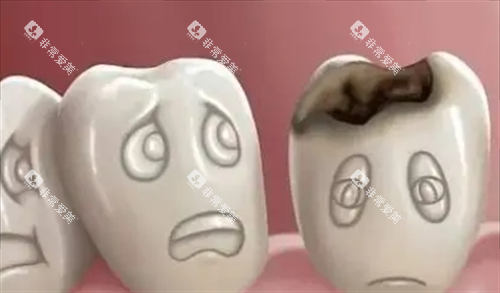 烂牙齿动画展示