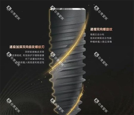 卡尔斯种植牙种植体螺纹照片