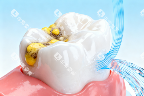 牙齿清洁卡通图