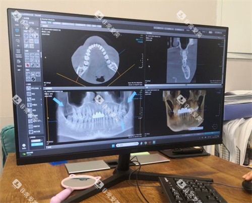 北京牙元素口腔牙齿拍片室