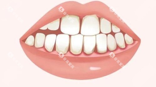 牙周炎卡通 牙周炎卡通