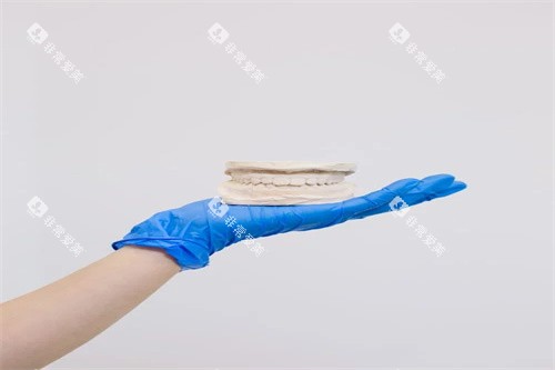 牙齿矫正示意展示 牙齿矫正示意展示