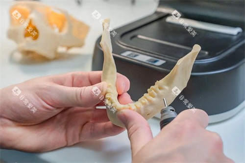 牙齿模型材料示意图 牙齿模型材料示意图