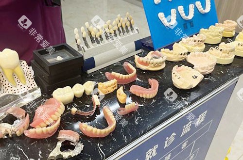 嘉兴唯美口腔牙齿模型展示 嘉兴唯美口腔牙齿模型展示