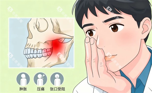 牙齿问题 牙齿问题