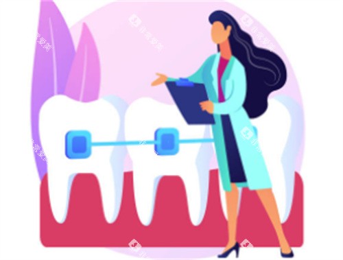 牙医介绍牙齿自锁