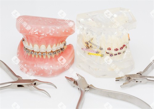 牙齿模型图片展示图 牙齿模型图片展示图