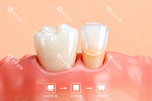 健康牙齿卡通展示图 健康牙齿卡通展示图