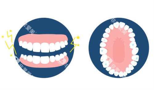 牙齿排列图 牙齿排列图