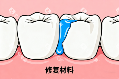 牙齿修复材料展示图