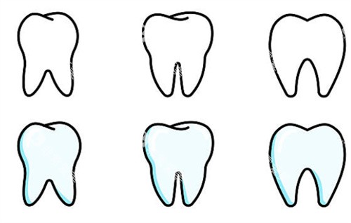 牙齿不同状态