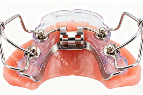 牙齿保持器模型图