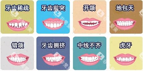 牙齿矫正不同适应症漫画图