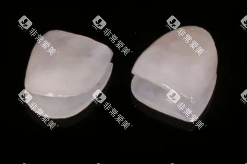 牙贴面材料卡通图