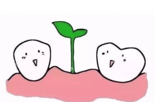 种植牙概念图 种植牙概念图