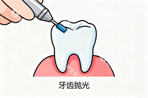 牙齿抛光卡通图