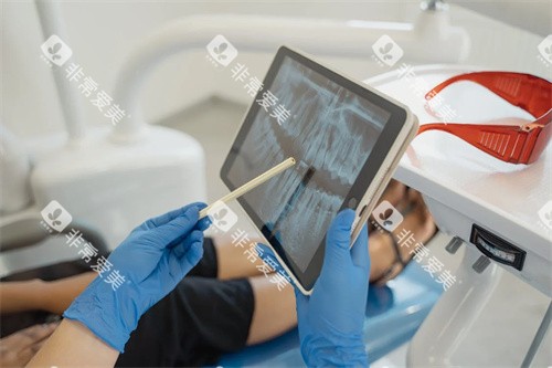 牙齿治疗沟通图 牙齿治疗沟通图