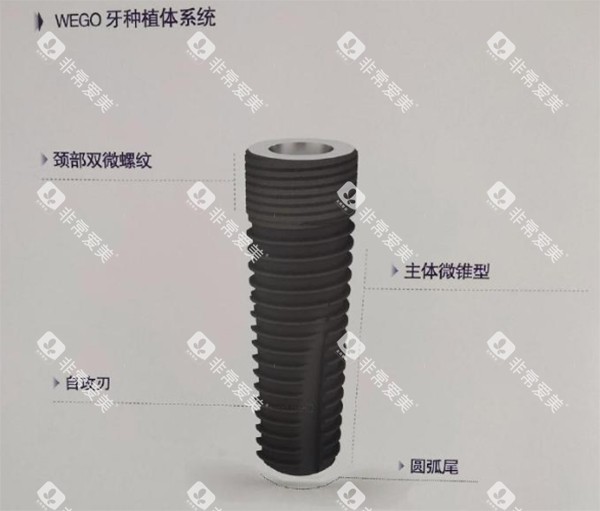 威高wego种植牙颈部双位螺纹细节照片 威高wego种植牙颈部双位螺纹细节照片