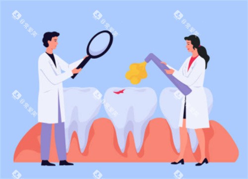 牙齿检查示意图