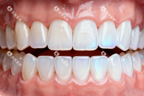 整齐健康牙齿模型图