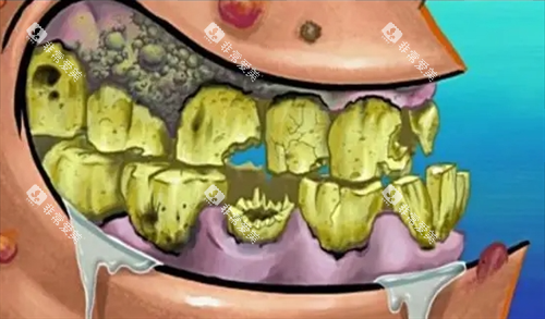 口腔烂牙齿动画展示