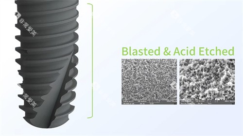 利多齿种植牙材料 利多齿种植牙材料