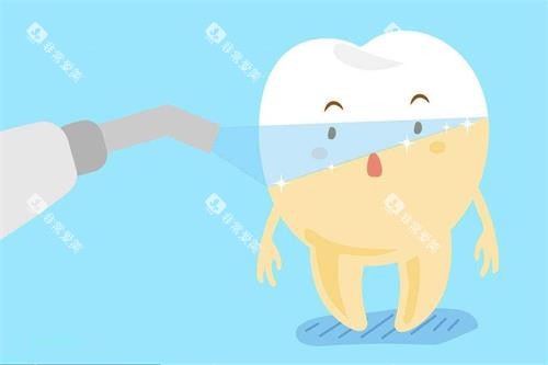 牙齿冷光美白示意图 牙齿冷光美白示意图