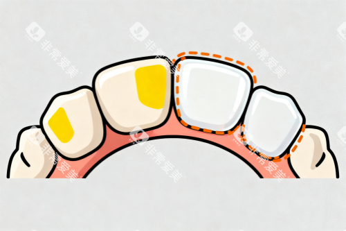 牙齿美白修复卡通图