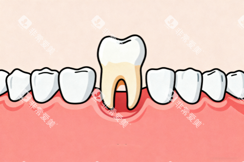 拔牙卡通图 拔牙卡通图