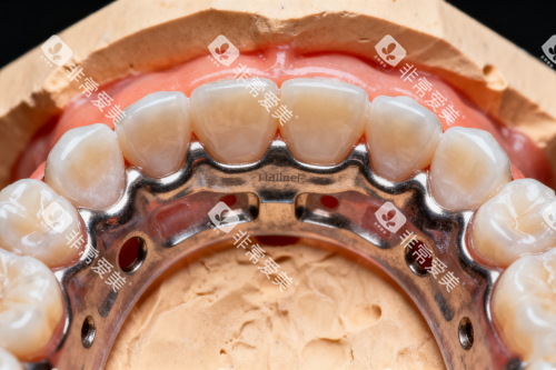 牙齿矫正之后的样子展示