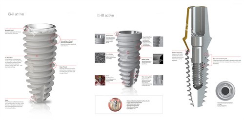 韩国纽百特种植牙植体设计 韩国纽百特种植牙植体设计
