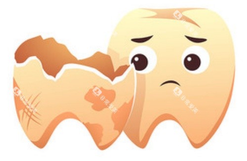 牙齿腐蚀示意图