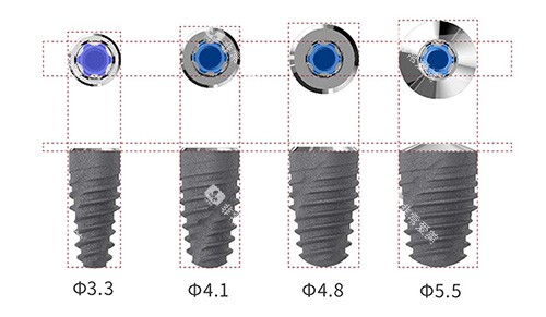 卡尔斯种植牙植体型号