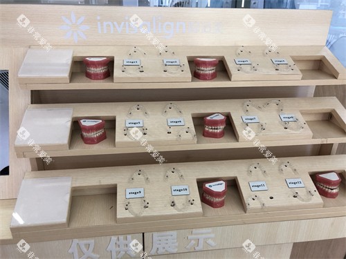 成都极光口腔锦江区牙膜