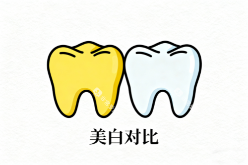 牙齿美白前后对比展示图