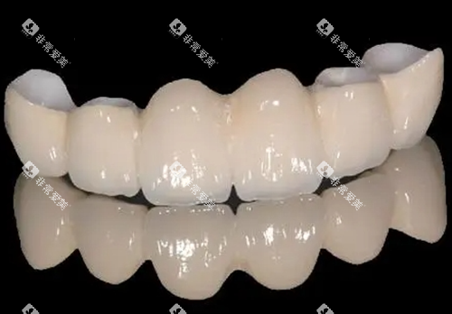 二氧化锆全瓷牙模型展示 二氧化锆全瓷牙模型展示